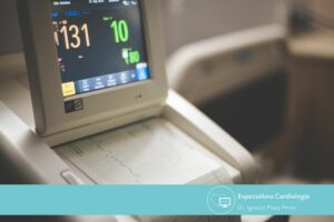 Electrocardiograma, cuida tu salud cardiovascular