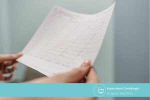Descubre sus causas, síntomas y diagnóstico fibrilación auricular