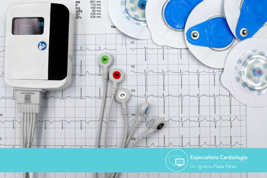 ¿Qué es una arritmia cardiaca y cuándo acudir al cardiólogo?